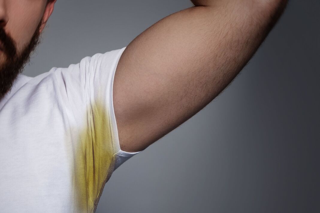 Homme le bras soulevant montrant une tache jaune sur les aisselles de chemise blanche