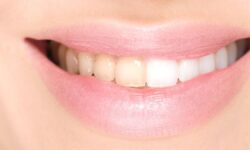 La révolution du blanchiment des dents arrive en Espagne sous forme de dentifrice, déjà n°1 sur Amazon